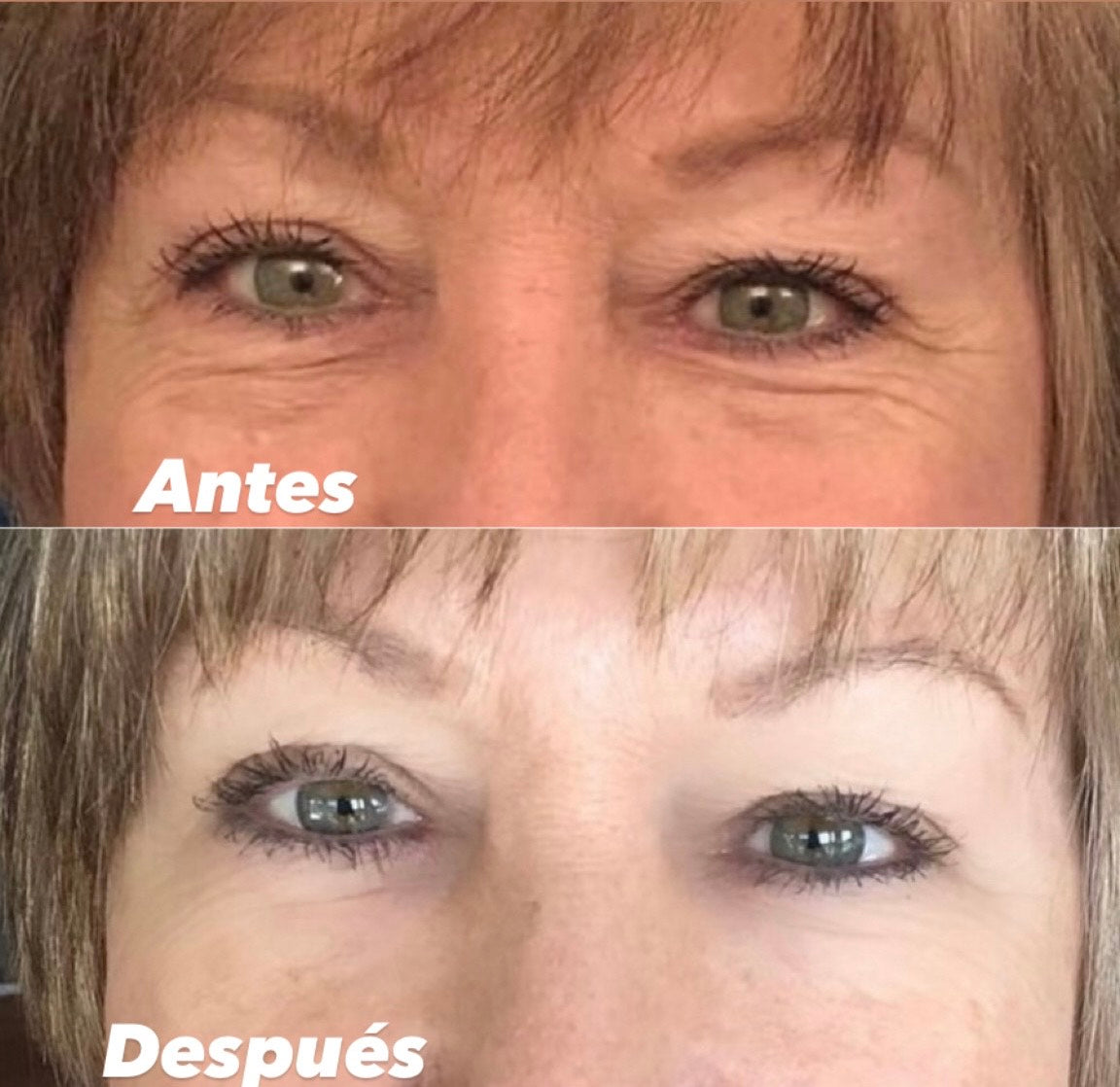 Serum Anti-envejecimiento