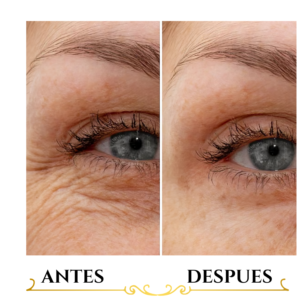 Serum Anti-envejecimiento